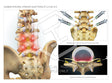 Image 09765_im05: Lumbar Epidural Steroid Injections at L3-4 and L4-5 Illustration - Trial Guides